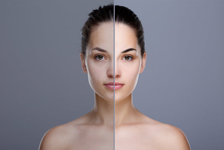 Skin Lightening & Pigmentation